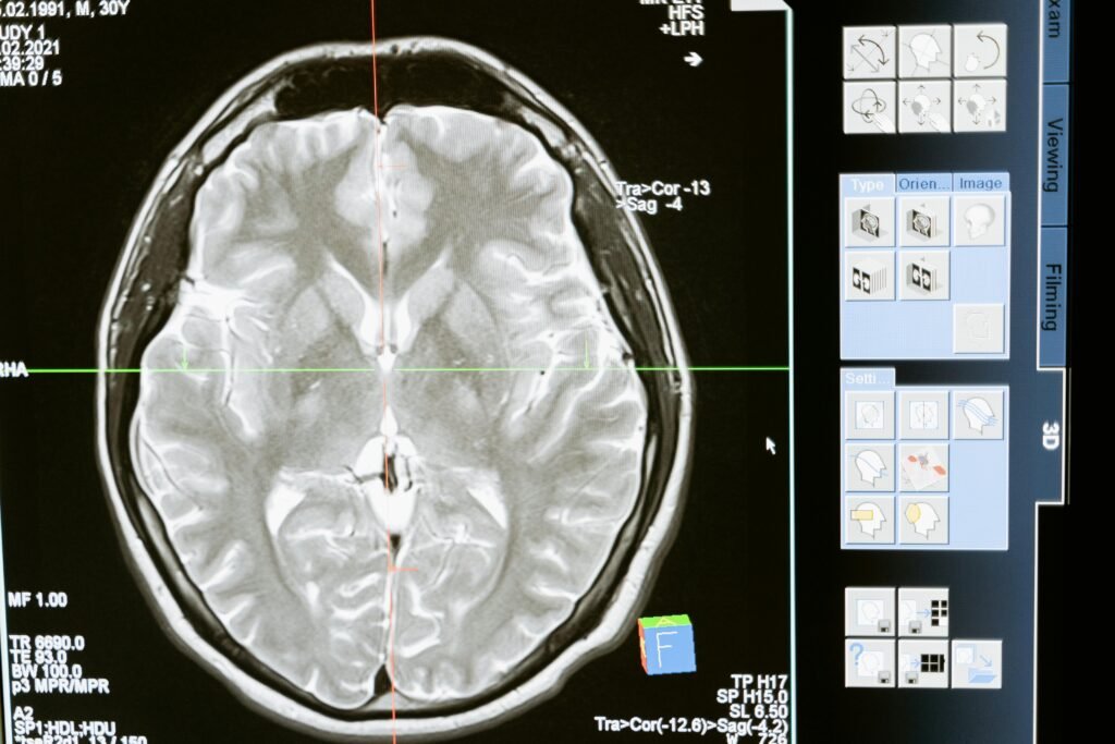 A creatina pode impulsionar a saúde cerebral